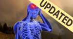 A skeleton holding head with brain showing depicting a headache with updated banner..